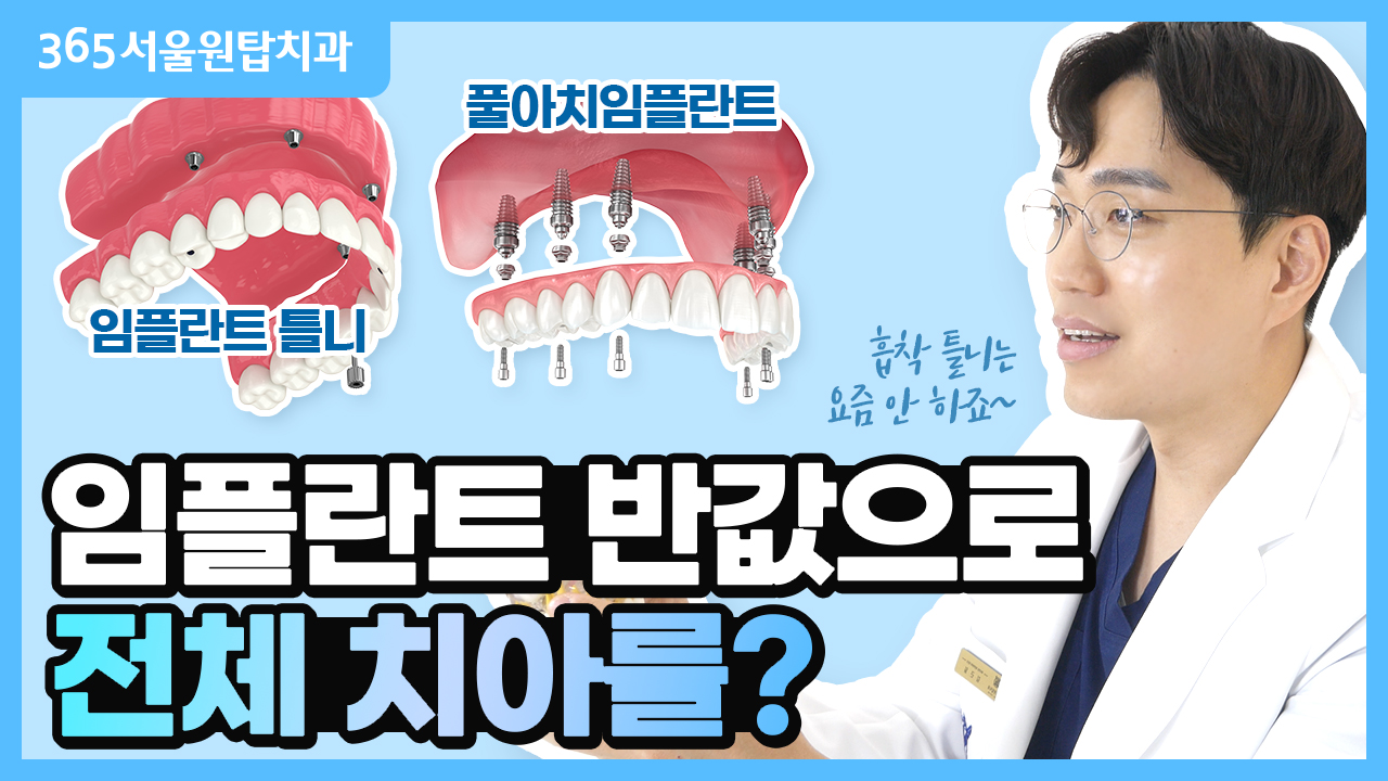 임플란트 가격 반 값으로 전체 보철 치료하기?!