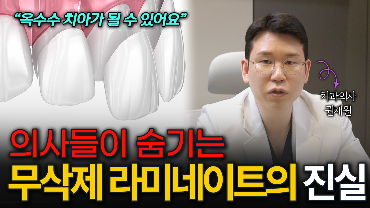 무삭제 라미네이트, 의사들이 숨기는 진실, 솔직하게 말씀드리겠습니다