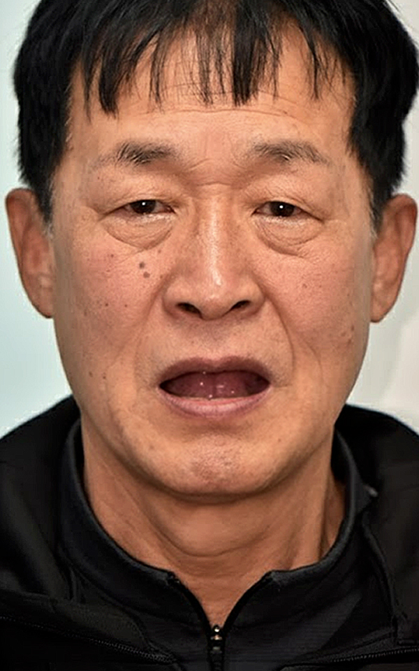 치료 전