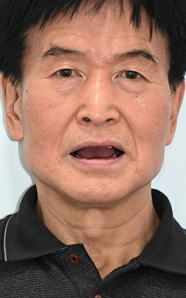 치료 전
