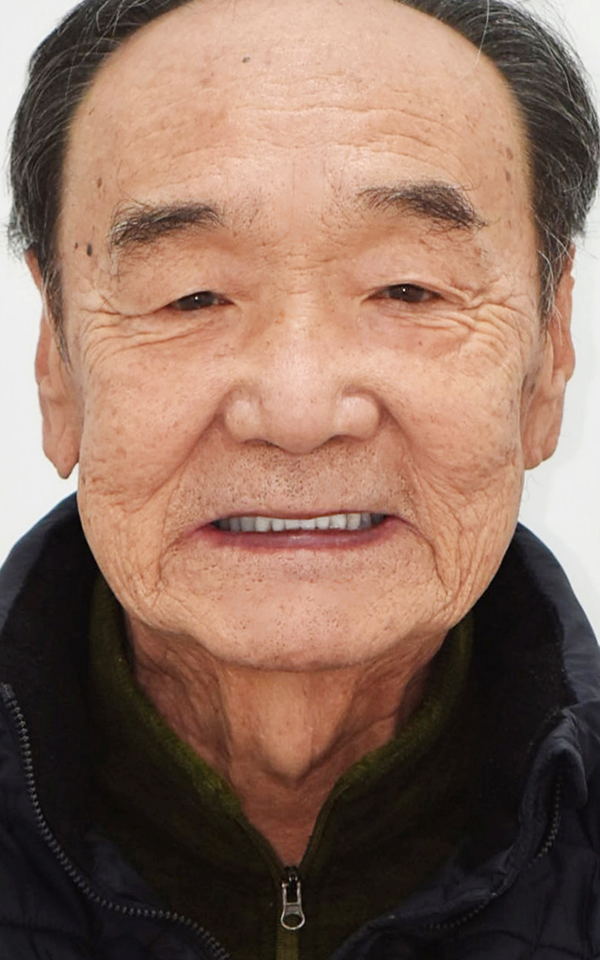 치료 후
