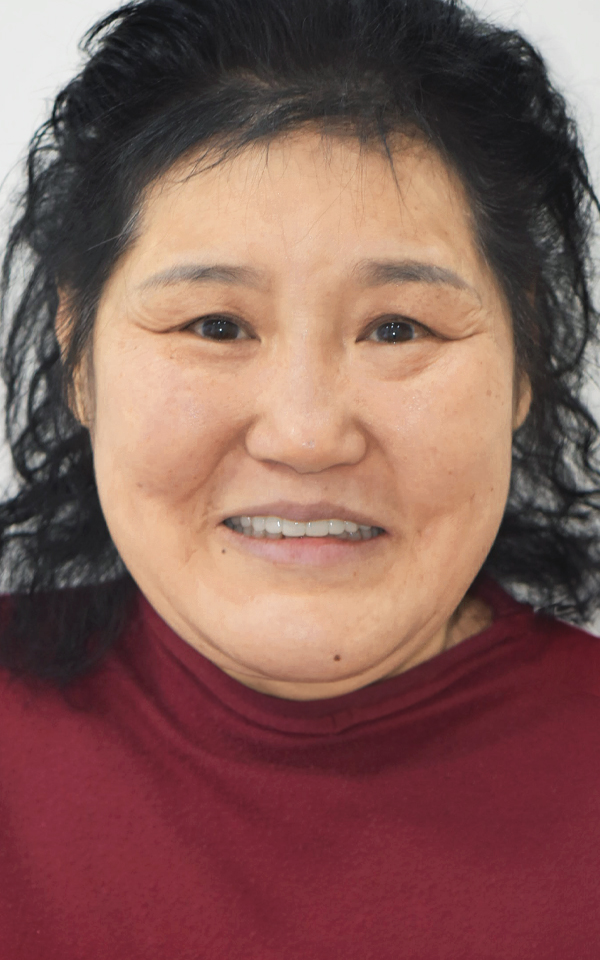 치료 후