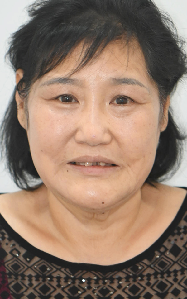 치료 전